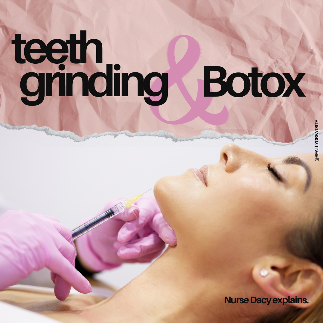 Botox helps with grinding teeth