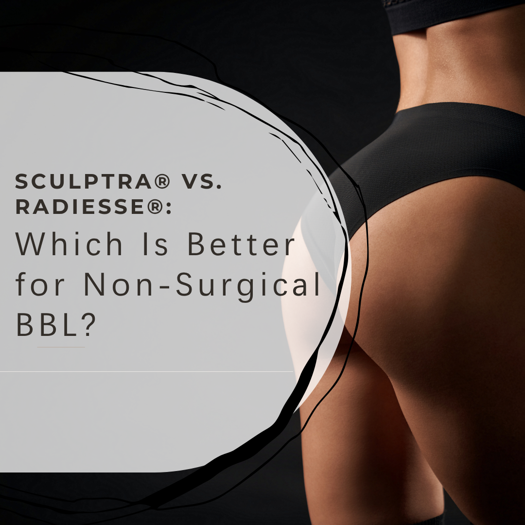 Sculptra vs. Radiesse for Non-Surgical BBL – Which Filler is Best for You